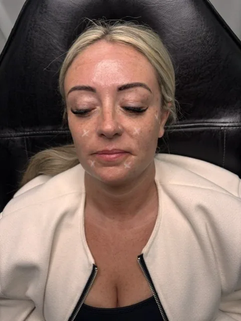 Anti-Wrinkle