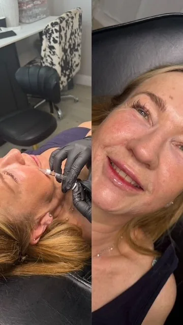 Lash Lift